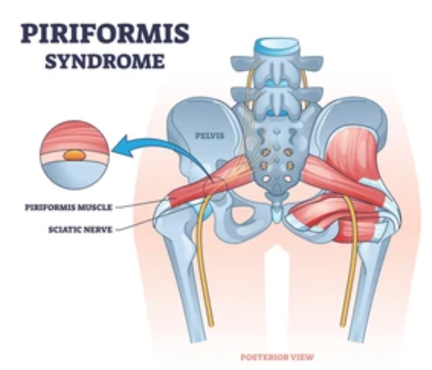 piriformis_orig